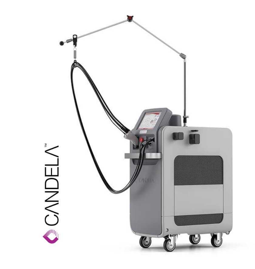 CANDELA LASER DEVICE 20-22-24MM LENS SET